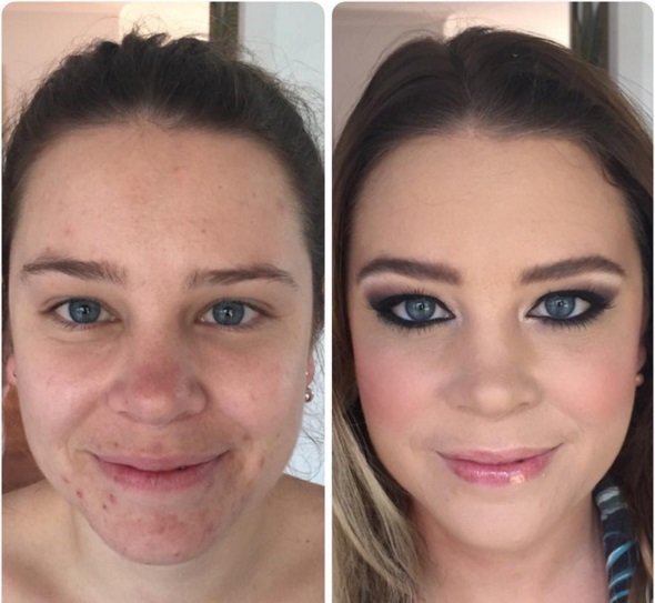 До и после: как макияж может преобразить проблемную кожу