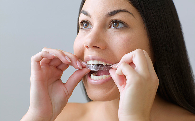 Как отбелить зубы в домашних условиях: 5 эффективных и безопасных способов